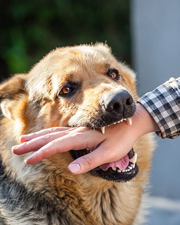 Seeking Medical Treatment for Dog Bites